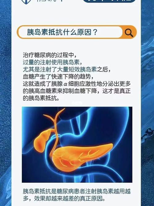 广电流量卡之所以贵，主要可以归结为以下几个原因